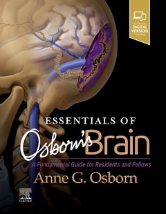 Couverture de l’ouvrage Essentials of Osborn's Brain
