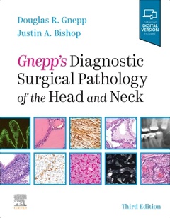 Couverture de l’ouvrage Gnepp's Diagnostic Surgical Pathology of the Head and Neck