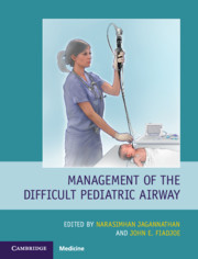 Couverture de l’ouvrage Management of the Difficult Pediatric Airway