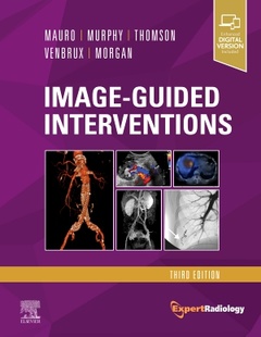 Couverture de l’ouvrage Image-Guided Interventions