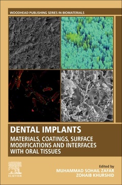 Couverture de l’ouvrage Dental Implants