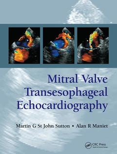 Couverture de l’ouvrage Mitral Valve Transesophageal Echocardiography