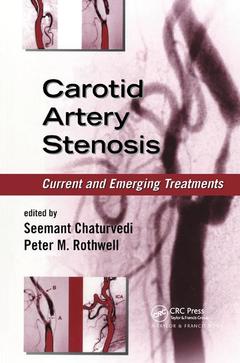 Couverture de l’ouvrage Carotid Artery Stenosis