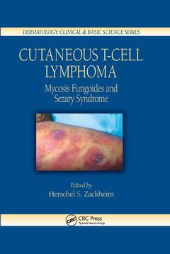 Couverture de l’ouvrage Cutaneous T-Cell Lymphoma