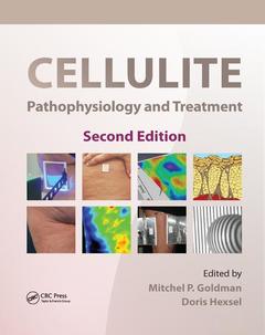 Cover of the book Cellulite