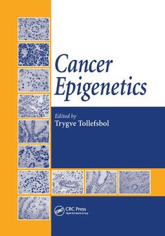 Couverture de l’ouvrage Cancer Epigenetics