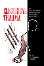 Couverture de l’ouvrage Electrical Trauma