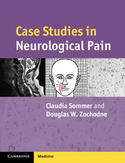Couverture de l’ouvrage Case Studies in Neurological Pain