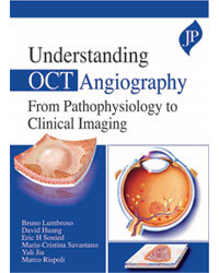 Couverture de l’ouvrage Understanding OCT Angiography