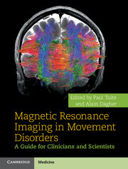 Couverture de l’ouvrage Magnetic Resonance Imaging in Movement Disorders