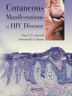 Couverture de l’ouvrage Cutaneous Manifestations of HIV Disease