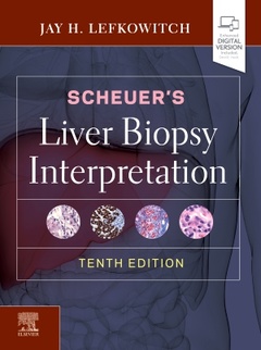 Couverture de l’ouvrage Scheuer's Liver Biopsy Interpretation