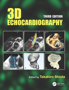 Couverture de l’ouvrage 3D Echocardiography