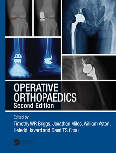 Couverture de l’ouvrage Operative Orthopaedics