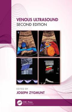 Couverture de l’ouvrage Venous Ultrasound