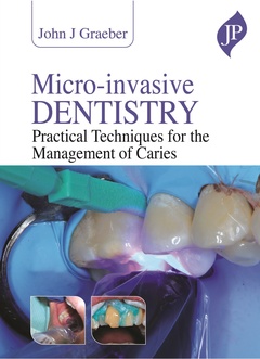 Couverture de l’ouvrage Microinvasive Dentistry