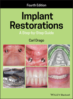 Couverture de l’ouvrage Implant Restorations