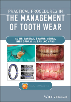 Couverture de l’ouvrage Practical Procedures in the Management of Tooth Wear