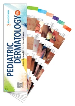 Couverture de l’ouvrage Pediatric Dermatology DDX Deck