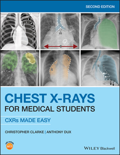 Cover of the book Chest X-Rays for Medical Students