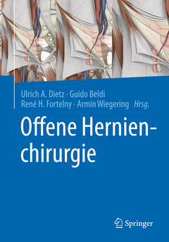 Couverture de l’ouvrage Offene Hernienchirurgie