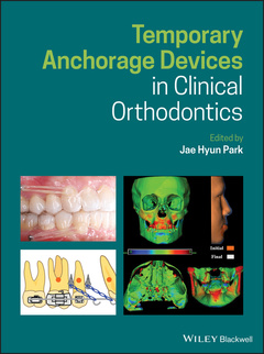 Couverture de l’ouvrage Temporary Anchorage Devices in Clinical Orthodontics