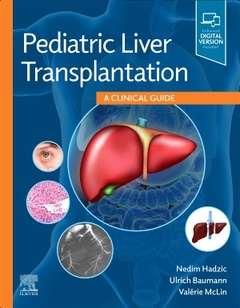 Couverture de l’ouvrage Pediatric Liver Transplantation