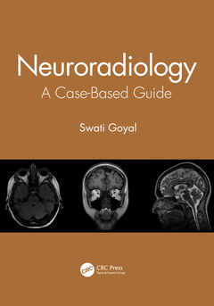 Cover of the book Neuroradiology