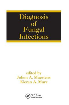 Couverture de l’ouvrage Diagnosis of Fungal Infections
