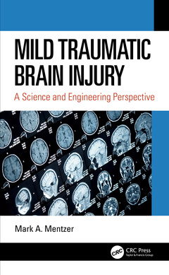 Couverture de l’ouvrage Mild Traumatic Brain Injury