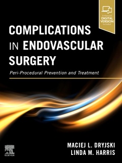 Couverture de l’ouvrage Complications in Endovascular Surgery