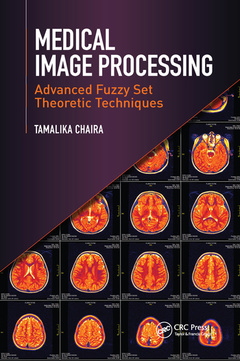 Couverture de l’ouvrage Medical Image Processing