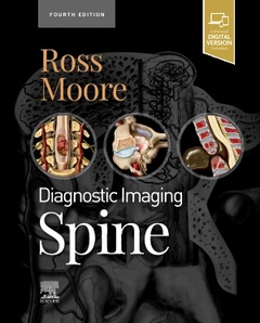 Couverture de l’ouvrage Diagnostic Imaging: Spine