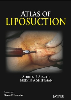 Couverture de l’ouvrage Atlas of Liposuction