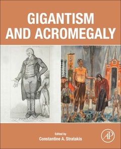 Couverture de l’ouvrage Gigantism and Acromegaly
