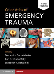 Couverture de l’ouvrage Color Atlas of Emergency Trauma