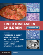 Cover of the book Liver Disease in Children