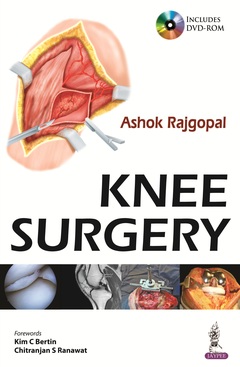 Couverture de l’ouvrage Knee Surgery