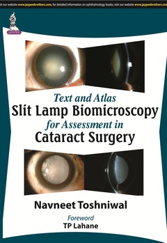 Cover of the book Text and Atlas: Slit Lamp Biomicroscopy for Assessment in Cataract Surgery