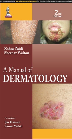 Couverture de l’ouvrage A Manual of Dermatology
