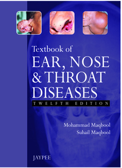 Couverture de l’ouvrage Textbook of Ear, Nose and Throat Diseases