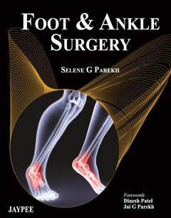 Couverture de l’ouvrage Foot and Ankle Surgery