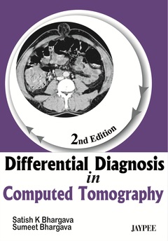 Couverture de l’ouvrage Differential Diagnosis In Computed Tomography