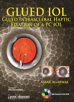 Cover of the book GLUED IOL