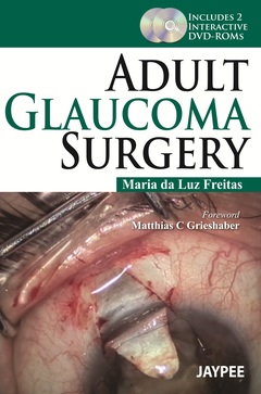 Couverture de l’ouvrage Adult Glaucoma Surgery