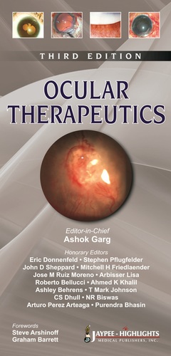 Couverture de l’ouvrage Ocular Therapeutics