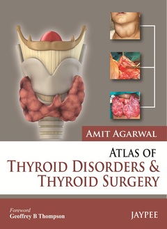 Cover of the book Atlas of Thyroid Disorders and Thyroid Surgery
