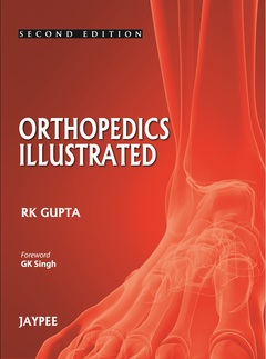 Cover of the book Orthopedics Illustrated