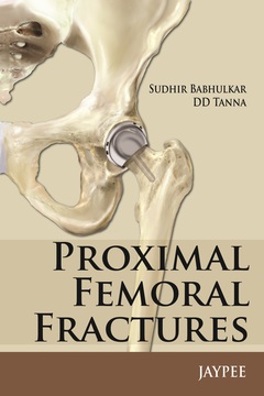Couverture de l’ouvrage Proximal Femoral Fractures