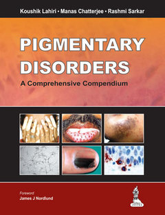 Cover of the book Pigmentary Disorders